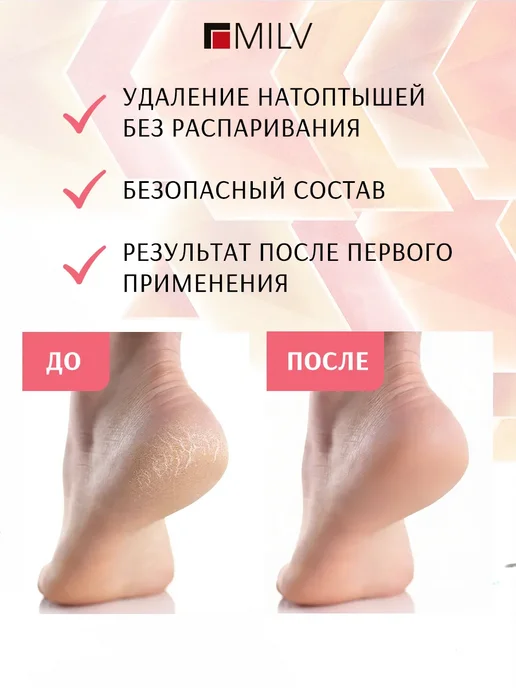 Жидкое лезвие кератолитик и терка для пяток профессиональная, 200 мл, фото 2