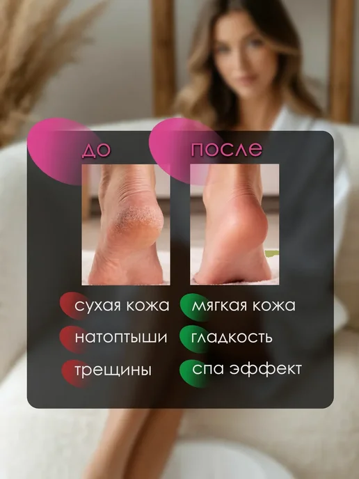с кератолитиком для ног аромат Цитрус, вариант, фото 3