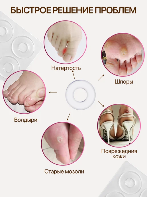 FORTBASE Пластырь от мозолей Разгрузка от мозолей силиконовая, 12 шт, фото 7